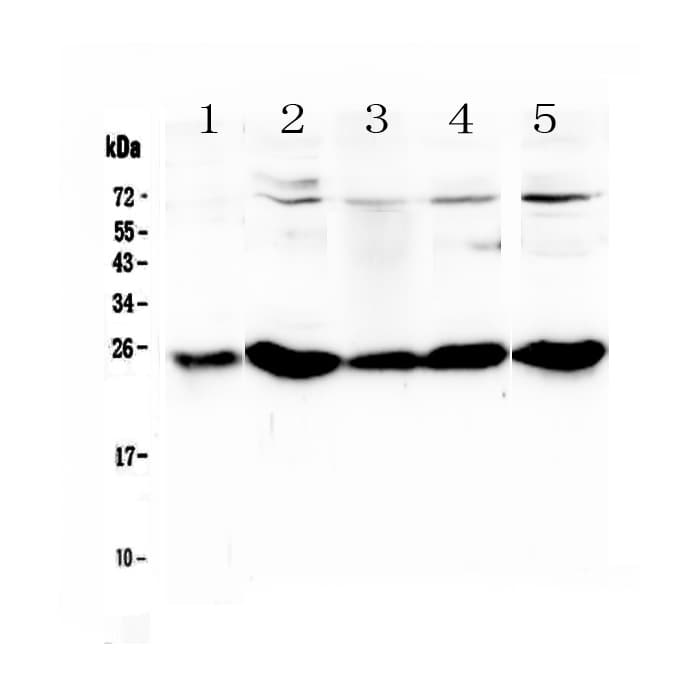 PGF / PLGF Antibody