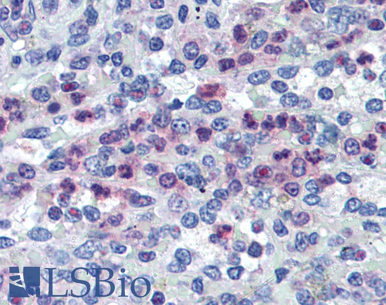 ALOX5 / 5-LOX Antibody (C-Terminus, Biotin)