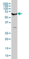 IHC-plus™ Monoclonal Mouse anti-Human BAF60B / SMARCD2 Antibody (clone 2F7, IHC, IF, WB)