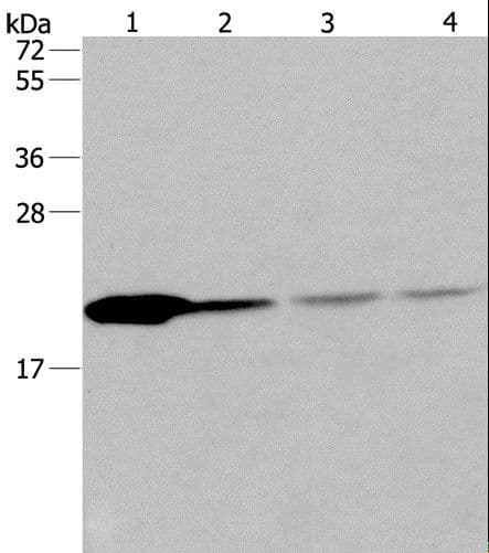 Polyclonal Rabbit anti-Human PPIB / Cyclophilin B Antibody (IHC, WB)