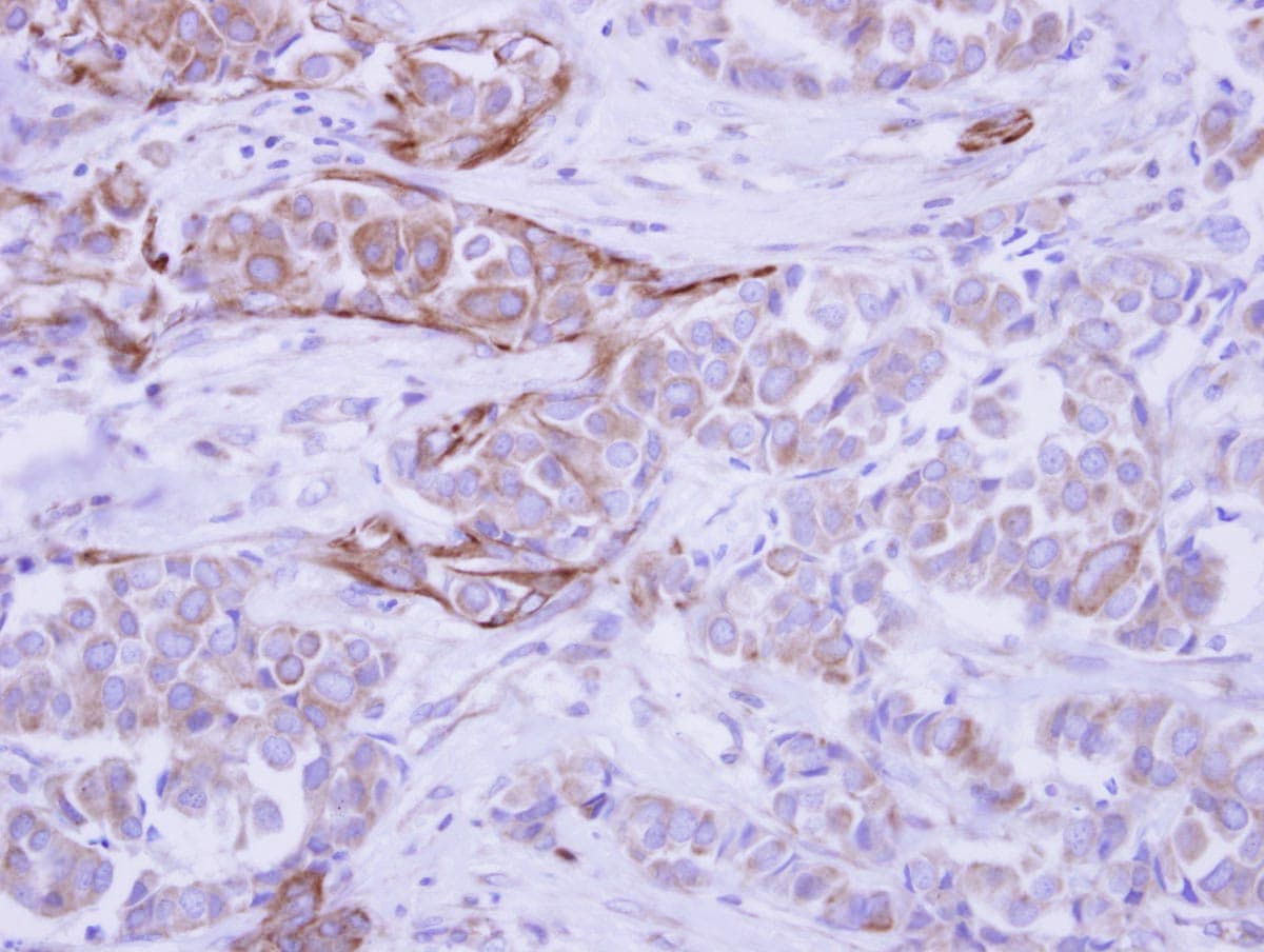 WDR49 Antibody