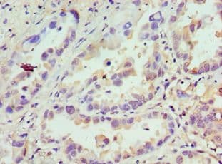 CDCA8 / Borealin Antibody (aa1-280)