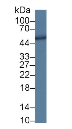 DPP2 / DPP7 Antibody (aa28-486, PE)