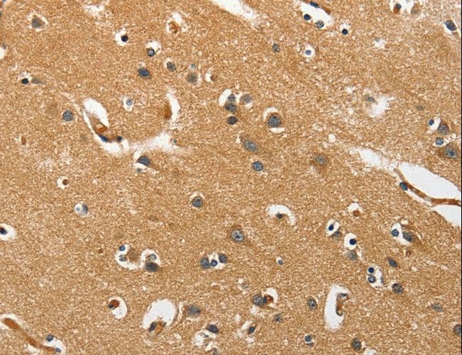 EPHB3 / EPH Receptor B3 Antibody