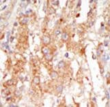 Polyclonal Rabbit anti-Human MAP3K6 / MEKK6 Antibody (aa1028-1058, IHC, WB)