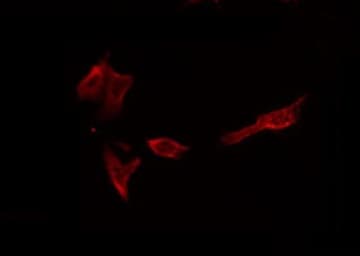 MMP1 Antibody