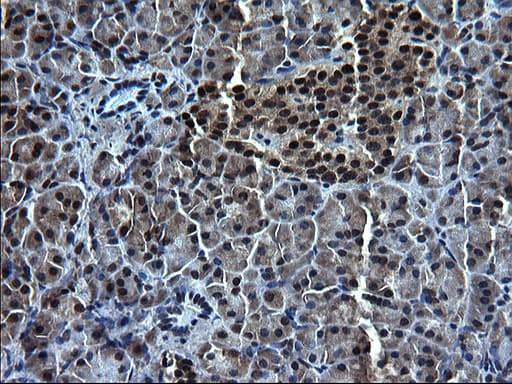ZFAND3 / TEX27 Antibody (clone OTI1H9)