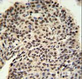 Polyclonal Rabbit anti-Human PRPF19 / PRP19 Antibody (aa4-33, IHC, WB)