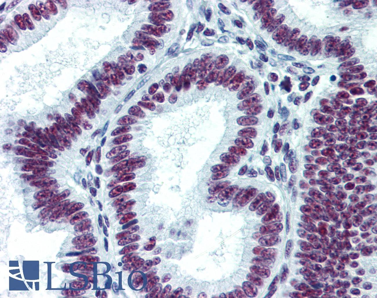 IHC-plus™ CDKL1 Antibody (clone 1F12)