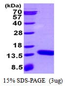 Mouse S100A3 / S100E Protein (Recombinant His)