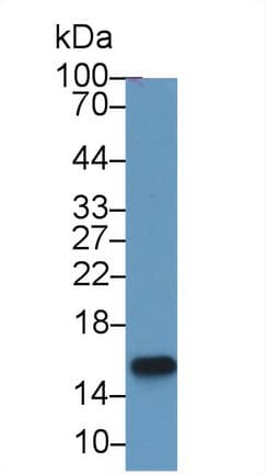 MSMB / MSP Antibody (aa19-114)