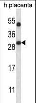 SIRT5 / Sirtuin 5 Antibody (aa99-127)
