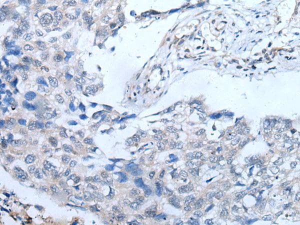 Polyclonal Rabbit anti-Human UBR4 Antibody (IHC)