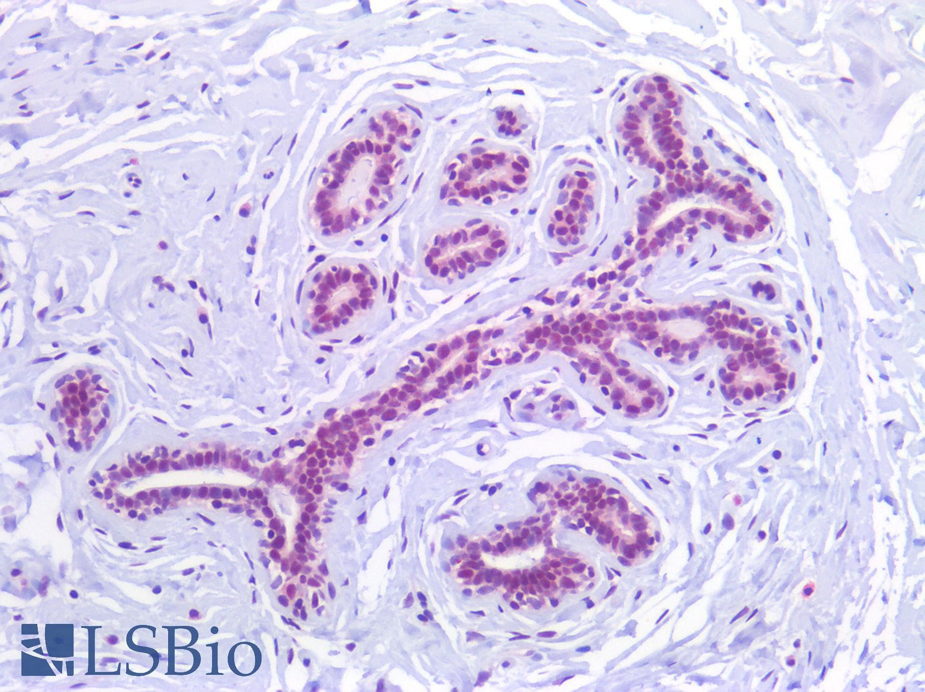 PathPlus™ FOXO1 / FKHR Antibody