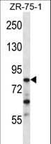Polyclonal Rabbit anti-Human CNOT3 Antibody (aa142-171, WB)