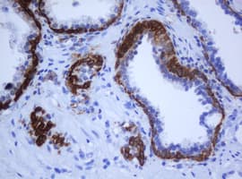 Monoclonal Mouse anti-Human KRT5 / CK5 / Cytokeratin 5 Antibody (clone OTI1F8, IHC)
