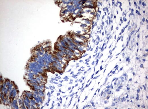 Monoclonal Mouse anti-Human CTAG1B / NY-ESO-1 Antibody (clone UMAB73, Carrier-free, IHC, IF, WB)