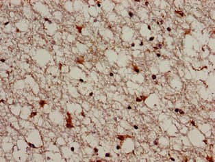 Polyclonal Rabbit anti-Human TRIM33 / TIF1-Gamma Antibody