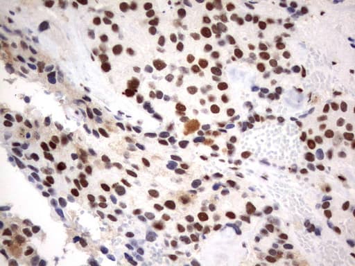PARN Antibody (aa1-266, clone UMAB143)