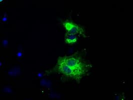 Monoclonal Mouse anti-Human L1CAM Antibody (clone OTI4F4, IHC, IF, WB)