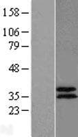 ABHD11 Protein (Over-Expression Lysate Myc-DDK (Flag))