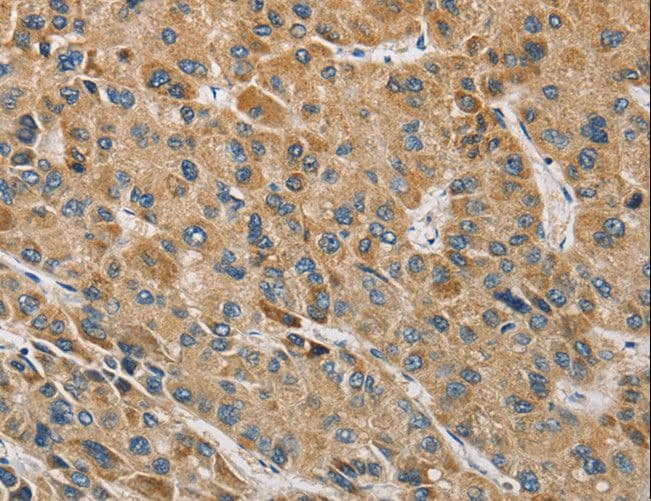 Polyclonal Rabbit anti-Human MIP / AQP0 / Aquaporin 0 Antibody (IHC)