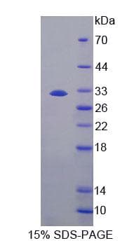 Mouse Carboxylesterase 1 / CES1 Protein (Recombinant His-T7, N-terminus)
