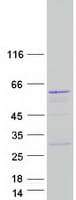 Human PAOX / PAO Protein (Recombinant Myc-DDK (Flag))