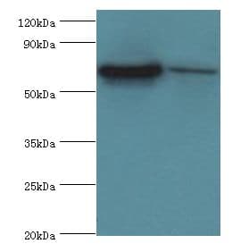 Polyclonal Rabbit anti-Human COT / CROT Antibody (aa1-87, IHC, WB)