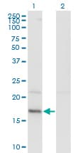 Monoclonal Mouse anti-Human HDDC3 Antibody (clone 7E6, WB)