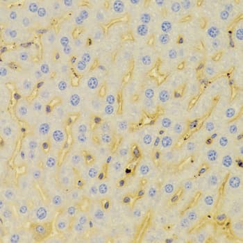 PCM1 Antibody