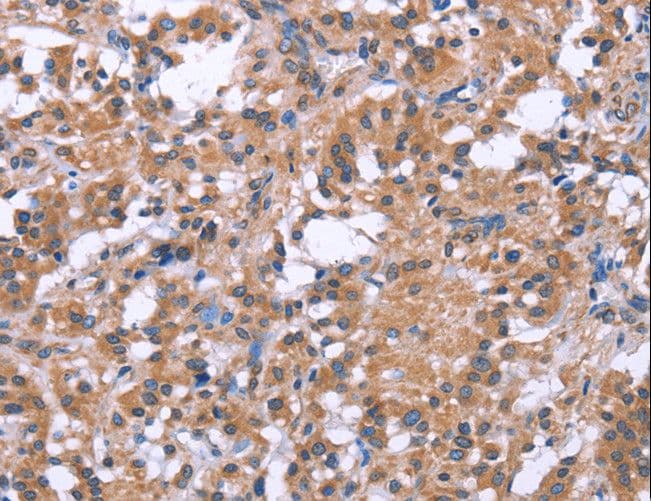 Polyclonal Rabbit anti-Human SLC52A1 / GPR172B / PAR2 Antibody (IHC)