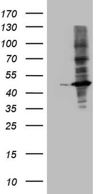 MTOR Antibody (aa1766-2144, clone OTI10A2)