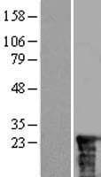SSSCA1 / p27 Protein (Over-Expression Lysate Myc-DDK (Flag))
