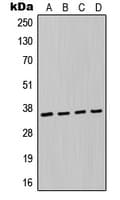 MAGEA6 Antibody (Internal)
