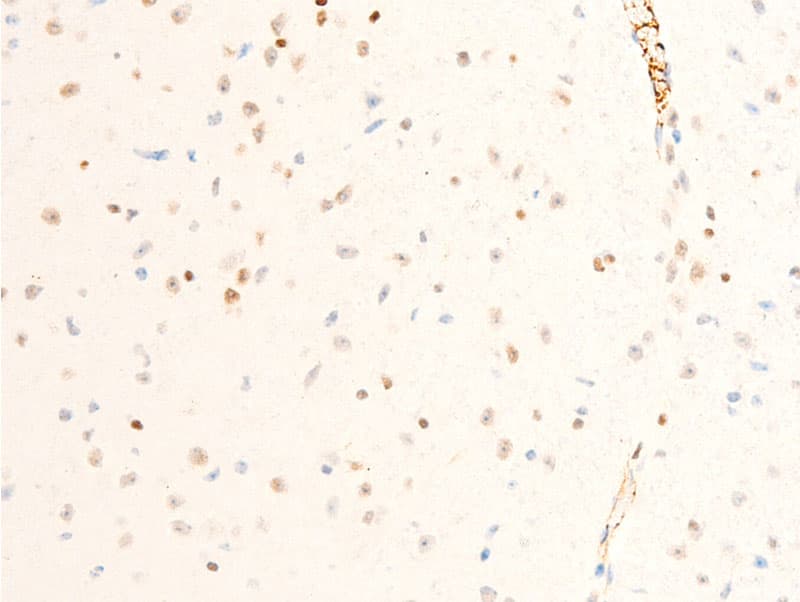 ICAM-1 / CD54 Antibody (phospho-Tyr512)