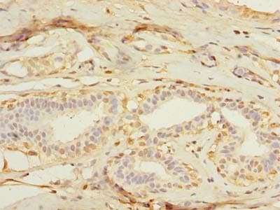Polyclonal Rabbit anti-Human MXD3 / MAD3 Antibody (IHC)