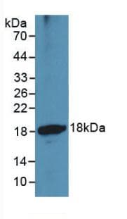 ADAMTS1 Antibody (aa476-614)
