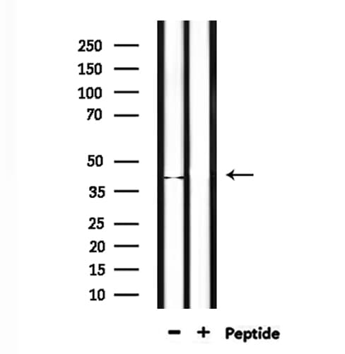 NEIL2 Antibody