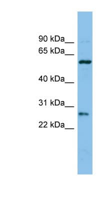 CTRB1 / Chymotrypsinogen B1 Antibody (aa71-120)