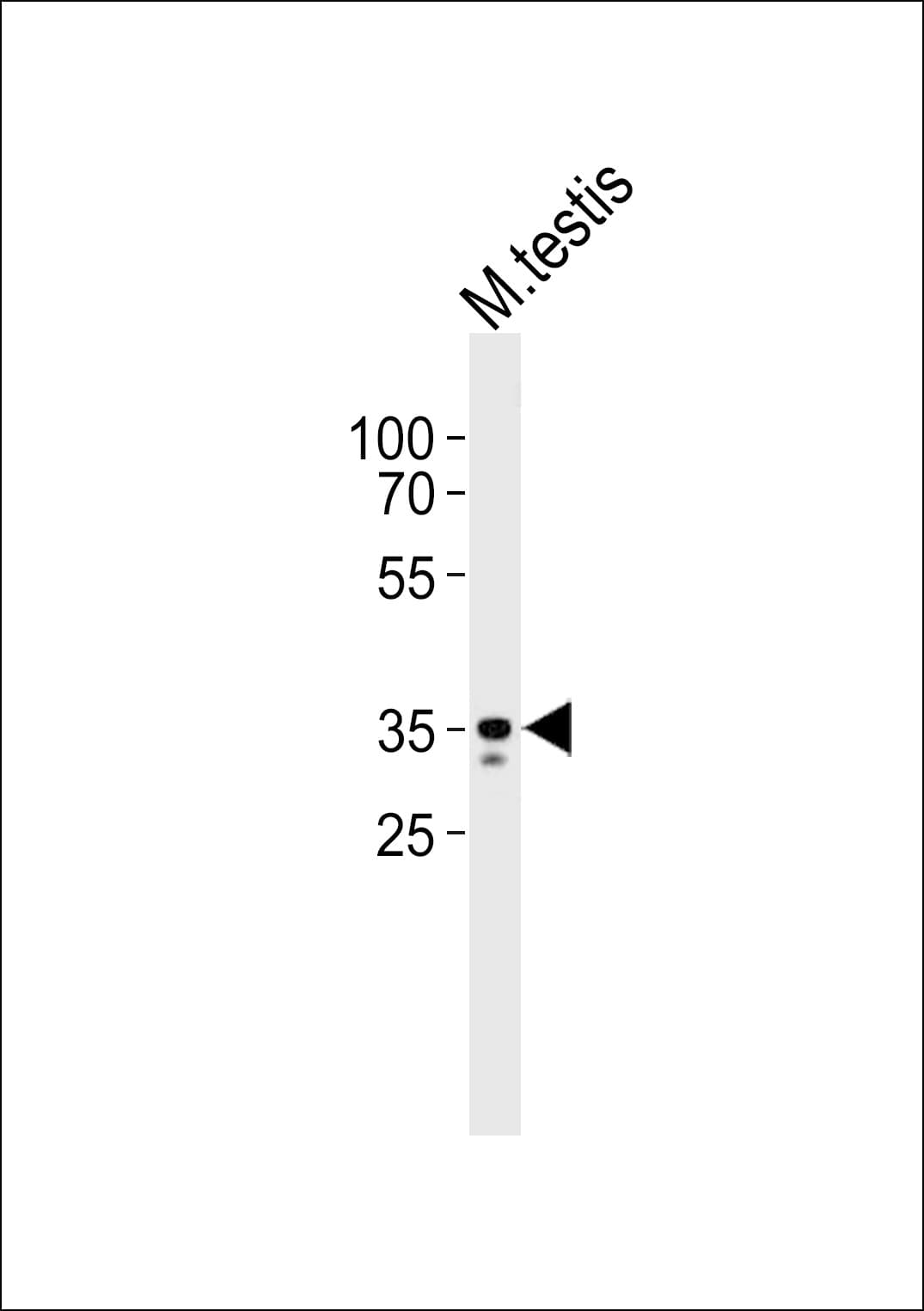 RING1 Antibody (aa306-340)