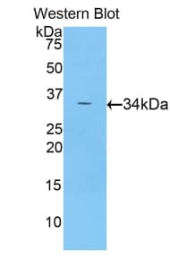 CDK4 Antibody (aa6-295, Biotin)