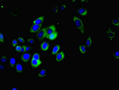 Polyclonal Rabbit anti-Human MFAP3L / NYD-Sp9 Antibody (IHC)