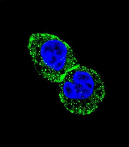 IDH1 / IDH Antibody (aa63-90)