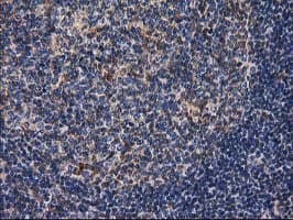 DSTN / Destrin Antibody (clone OTI2C10)