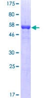 Human HDGFRP3 Protein (Recombinant GST)