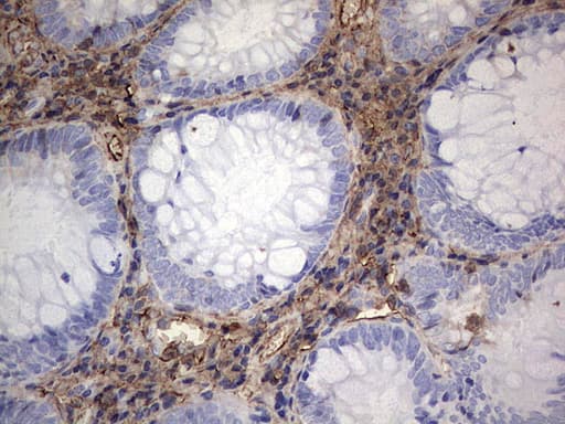 Monoclonal Mouse anti-Human S100A9 / MRP14 Antibody (clone OTI2A2, IHC)