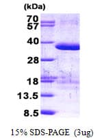 Human ZFAND1 Protein (Recombinant His)