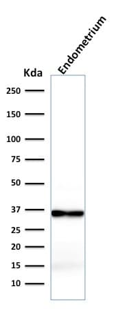 Recombinant Monoclonal Mouse anti-Human CNN1 / Calponin Antibody (clone rCNN1/832, IHC, WB)