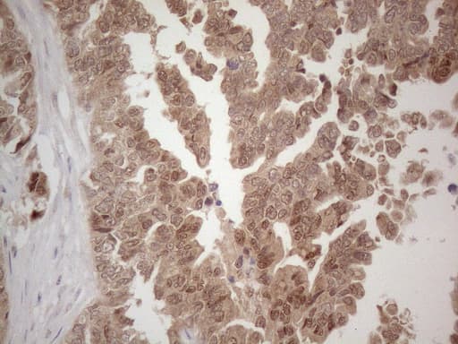 Monoclonal Mouse anti-Human SPATA22 Antibody (clone OTI6H9, IHC, WB)